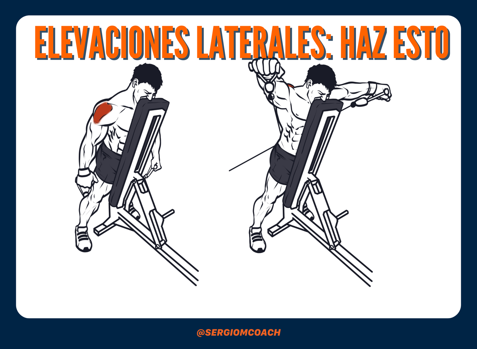 Elevaciones laterales